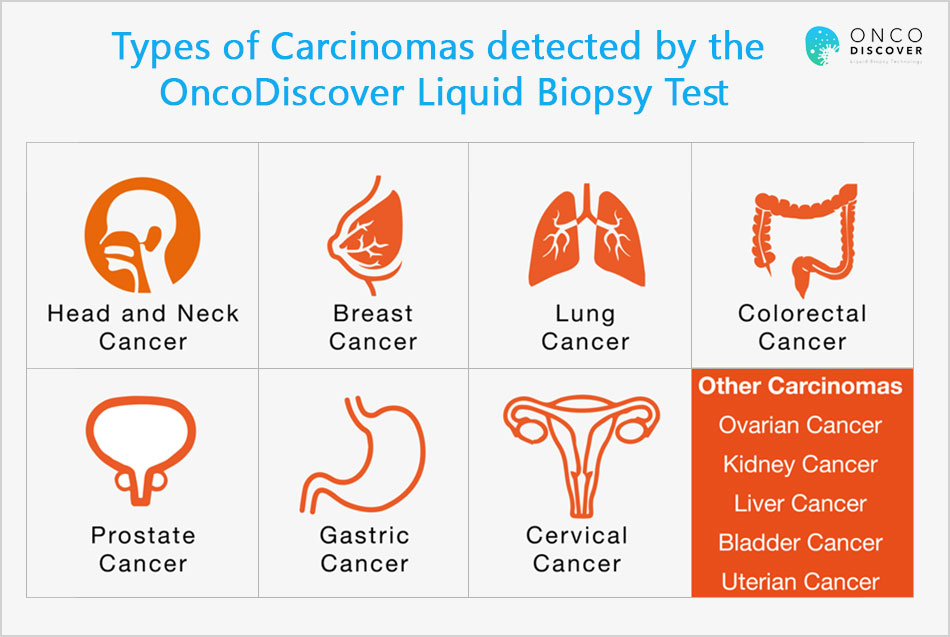 Types of Carcinomas detected by the OncoDiscover Liquid Biopsy Test